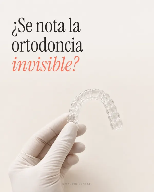 Carrusel: ¿Se nota la ortodoncia invisible?