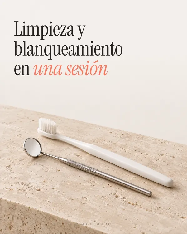 Carrusel: limpieza y blanqueamiento en una sesión
